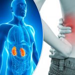 What causes kidney stones