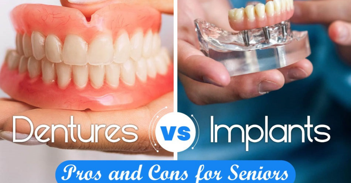 Dentures Vs Implants: Pros And Cons For Seniors